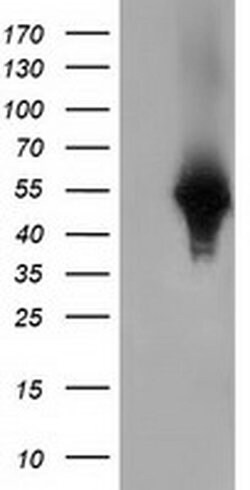 HP Monoclonal Antibody (OTI4H5), TrueMAB , OriGene 100 &mu;L; Unconjugated:Antibodies,