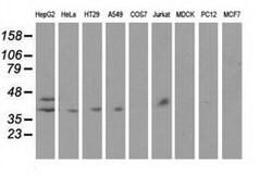 HP Monoclonal Antibody (OTI4H5), TrueMAB , OriGene:Antibodies:Primary Antibodies