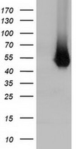 HP Monoclonal Antibody (OTI1B1), TrueMAB , OriGene 100 &mu;L; Unconjugated:Anticuerpos