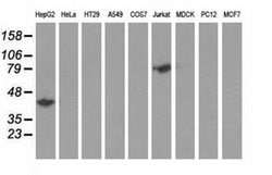 HP Monoclonal Antibody (OTI1B1), TrueMAB , OriGene 100 &mu;L; Unconjugated:Anticuerpos