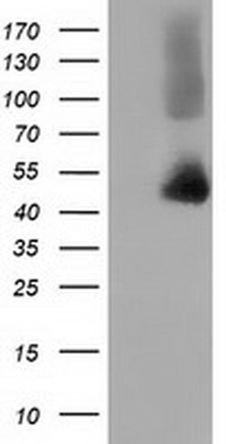 HP Monoclonal Antibody (OTI4C2), TrueMAB , OriGene:Antibodies:Primary Antibodies
