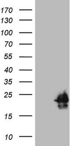 HPCAL4 Mouse anti-Human, Clone: OTI1D9, lyophilized, TrueMAB 100 &mu;g;