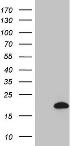 HPCAL4 Mouse anti-Human, Clone: OTI3F11, lyophilized, TrueMAB 100 &mu;g;