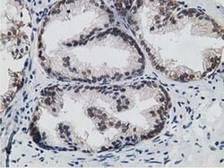 HPGD Monoclonal Antibody (OTI1E9), TrueMAB , OriGene:Antibodies:Primary