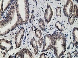 HPGD Monoclonal Antibody (OTI1E9), TrueMAB , OriGene 100 &mu;L; Unconjugated:Antibodies,