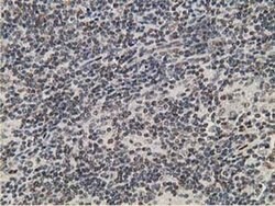 HPGD Monoclonal Antibody (OTI1E9), TrueMAB , OriGene 100 &mu;L; Unconjugated:Antibodies,