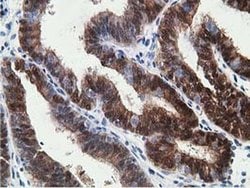 HPGD Monoclonal Antibody (OTI2C10), TrueMAB , OriGene 30 &mu;L; Unconjugated:Antibodies,