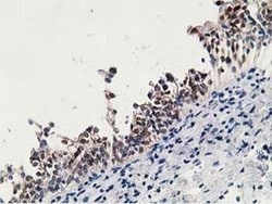 HPGD Monoclonal Antibody (OTI2C10), TrueMAB , OriGene 30 &mu;L; Unconjugated:Antibodies,