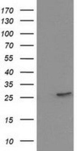 HPGD Mouse anti-Human, Clone: OTI1C12, lyophilized, TrueMAB 100 &mu;g;