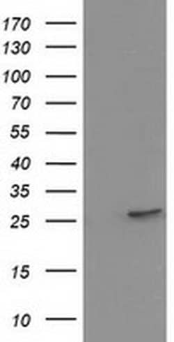 HPGD Monoclonal Antibody (OTI1C12), TrueMAB , OriGene 30 &mu;L; Unconjugated:Antibodies,