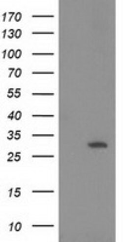 HPGD Mouse anti-Human, Clone: OTI2C10, lyophilized, TrueMAB 100 &mu;g;