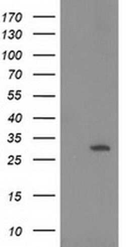 HPGD Monoclonal Antibody (OTI2C10), TrueMAB , OriGene 30 &mu;L; Unconjugated:Antibodies,