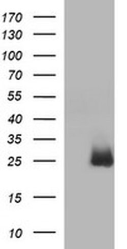 HPRT1 Monoclonal Antibody (OTI1B1), TrueMAB , OriGene 30 &mu;L | Buy Online | Origene Technologies | Fisher Scientific