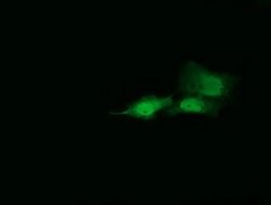 HRAS Monoclonal Antibody (OTI1F2), TrueMAB , OriGene:Antibodies:Primary