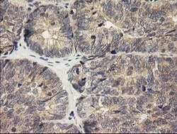 HRAS Monoclonal Antibody (OTI1C2), TrueMAB , OriGene 30 &mu;L; Unconjugated:Anticuerpos