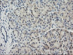 HRAS Monoclonal Antibody (OTI1C2), TrueMAB , OriGene 30 &mu;L; Unconjugated:Anticuerpos