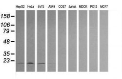 HRAS Monoclonal Antibody (OTI1F2), TrueMAB , OriGene:Antibodies:Primary