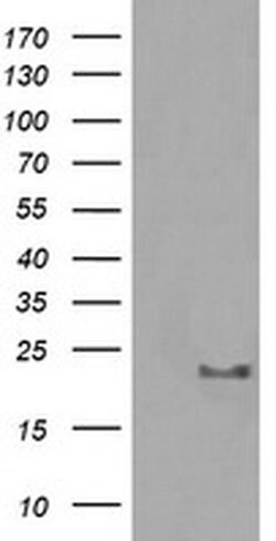 HRAS Monoclonal Antibody (OTI1C2), TrueMAB , OriGene:Anticuerpos:Anticuerpos