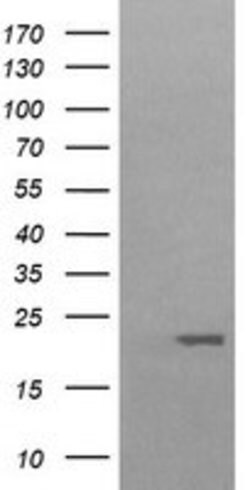 HRAS Mouse anti-Canine, Human, Mouse, Rat, Clone: OTI1H3, lyophilized,
