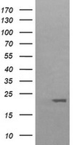 HRAS Monoclonal Antibody (OTI1H3), TrueMAB , OriGene:Antibodies:Primary