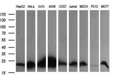 HRAS Mouse anti-Canine, Human, Mouse, Rat, Clone: OTI1H3, lyophilized,