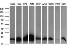 HRAS Monoclonal Antibody (OTI1H3), TrueMAB , OriGene 100 &mu;L; Unconjugated:Antibodies,