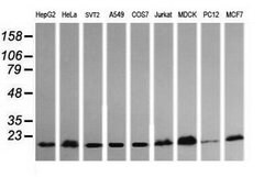 HRAS Mouse anti-Canine, Human, Mouse, Rat, Clone: OTI1A1, lyophilized,