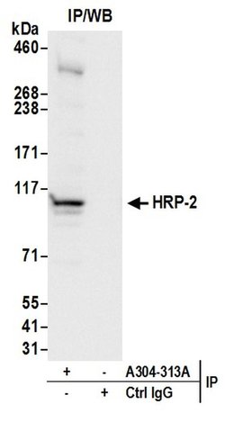 HRP-2 Rabbit anti-Human, Polyclonal, Bethyl Laboratories 100 &mu;L; Unconjugated:Antibodies,