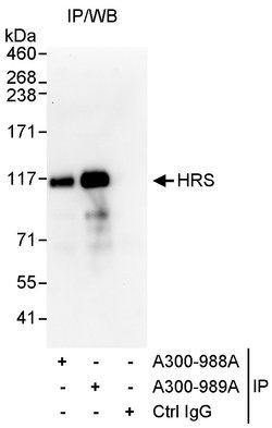 HRS Rabbit anti-Human, Polyclonal, Bethyl Laboratories 100 &mu;L; Unconjugated:Antibodies,
