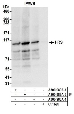 HRS Rabbit anti-Human, Mouse, Polyclonal, Bethyl Laboratories 100 &mu;L;