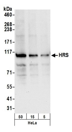 HRS Rabbit anti-Human, Mouse, Polyclonal, Bethyl Laboratories 100 &mu;L;