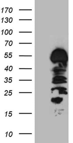 HS1BP3 Monoclonal Antibody (OTI6C6), TrueMAB , OriGene 30 &mu;L | Buy Online | Origene Technologies | Fisher Scientific
