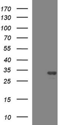 HSCB Monoclonal Antibody (OTI2D10), TrueMAB , OriGene:Antibodies:Primary