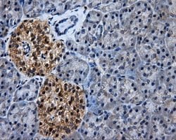 HSD17B10 Mouse anti-Human, Clone: OTI10B4, lyophilized, TrueMAB 100 &mu;g;