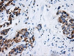 HSD17B10 Mouse anti-Human, Clone: OTI5E2, lyophilized, TrueMAB 100 &mu;g;