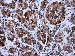 HSD17B10 Mouse anti-Human, Clone: OTI5E2, lyophilized, TrueMAB 100 &mu;g;