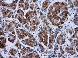 HSD17B10 Mouse anti-Human, Clone: OTI5E2, liquid, TrueMAB 100 &mu;L; Unconjugated:Antibodies,