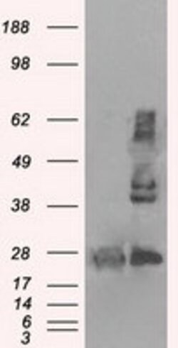 HSD17B10 Mouse anti-Human, Clone: OTI5E2, lyophilized, TrueMAB 100 &mu;g;