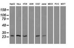 HSD17B10 Mouse anti-Human, Clone: OTI5E2, lyophilized, TrueMAB 100 &mu;g;