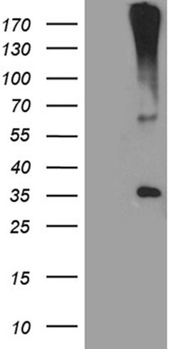HSD17B3 Monoclonal Antibody (OTI7F7), TrueMAB , OriGene 100 &mu;L | Buy Online | OriGene | Fisher Scientific