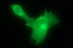 HSD17B4 Mouse anti-Human, Clone: OTI4F9, lyophilized, TrueMAB 100 &mu;g;