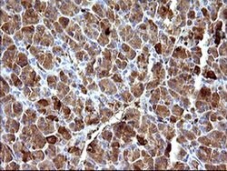 HSD17B4 Monoclonal Antibody (OTI1F3), TrueMAB , OriGene:Antibodies:Primary