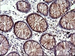 HSD17B4 Monoclonal Antibody (OTI1F3), TrueMAB , OriGene 100 &mu;L; Unconjugated:Antibodies,