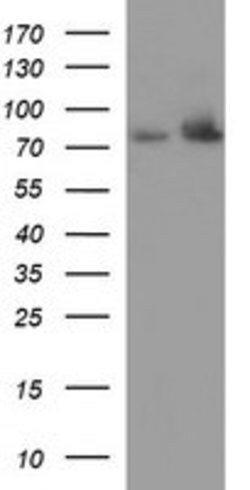 HSD17B4 Mouse anti-Human, Clone: OTI4F9, lyophilized, TrueMAB 100 &mu;g;