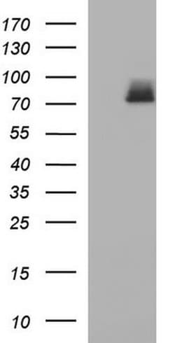 HSD17B4 Mouse anti-Human, Clone: OTI2C9, TrueMAB , Origene 30 &mu;L; Unconjugated:Antibodies,