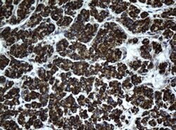 HSD17B8 Monoclonal Antibody (OTI6H2), TrueMAB , OriGene:Antibodies:Primary