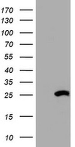 HSD17B8 Monoclonal Antibody (OTI2E12), TrueMAB , OriGene 30 &mu;L; Unconjugated:Antibodies,