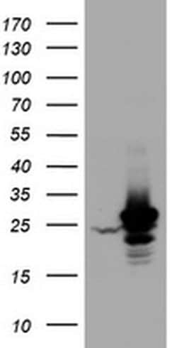 HSD17B8 Monoclonal Antibody (OTI6H2), TrueMAB , OriGene:Antibodies:Primary