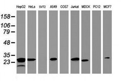 HSD17B8 Monoclonal Antibody (OTI6H2), TrueMAB , OriGene 100 &mu;L; Unconjugated:Antibodies,