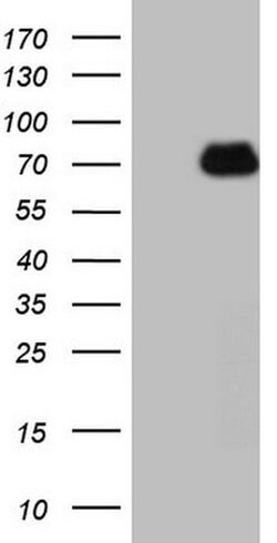 HSF2 Monoclonal Antibody (OTI2E2), TrueMAB , OriGene:Antibodies:Primary